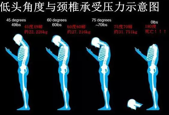 “颈椎杀手”竟然就是因为长期做这个动作！(图2)